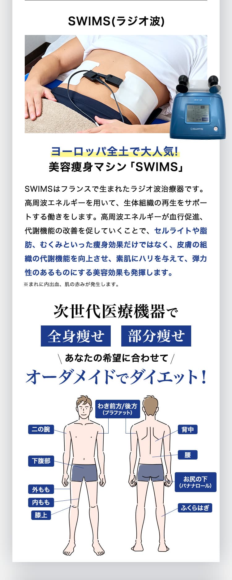 SWIMS（ラジオ波）